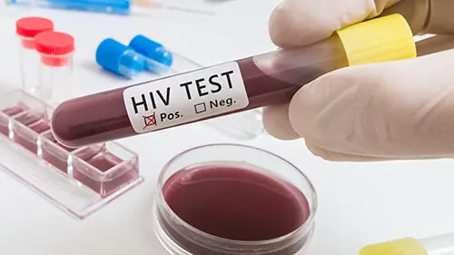 hiv-virus-medical-concept Facts about HIV